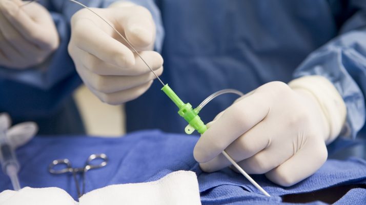 Surgeon Inserting Tube Into Patient During Surgery