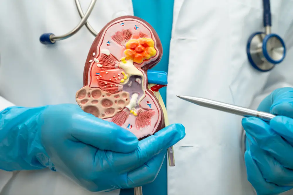 Kidney-Transplant-banner